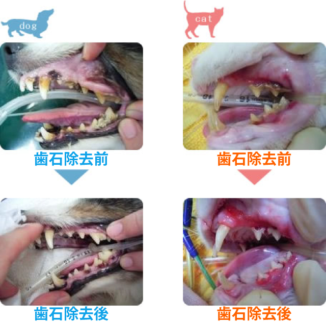 歯磨き・歯石